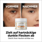 🥳 HEISSER SALE 2026 – 50% RABATT! 💞 70.000+ VERKAUFT ! Turmeric Exfoliating Body Scrub